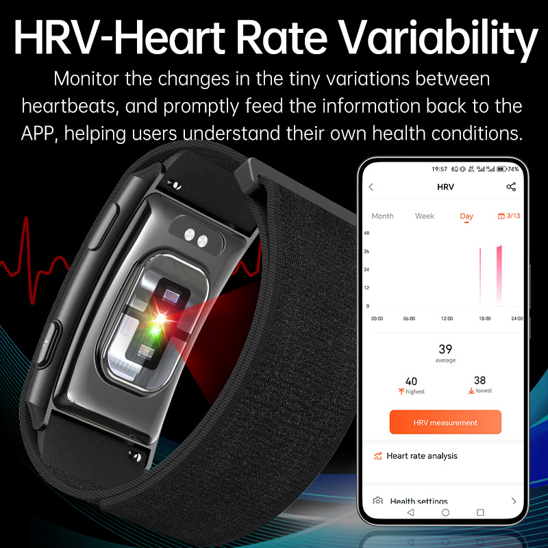VWAR Loop X ECG Smart Bracelet – обзор и цена Xbody Health & Wellness Functional Integrative Medicine Office & Medical Spa